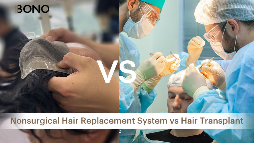 Nonsurgical Hair Replacement System vs Hair Transplant