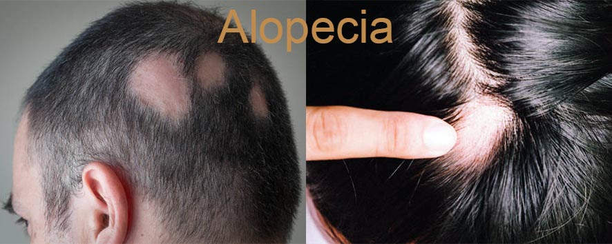 Men Hair Transplant (17)