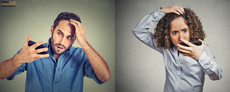 10 causes of hair losses.edited.edited (4)