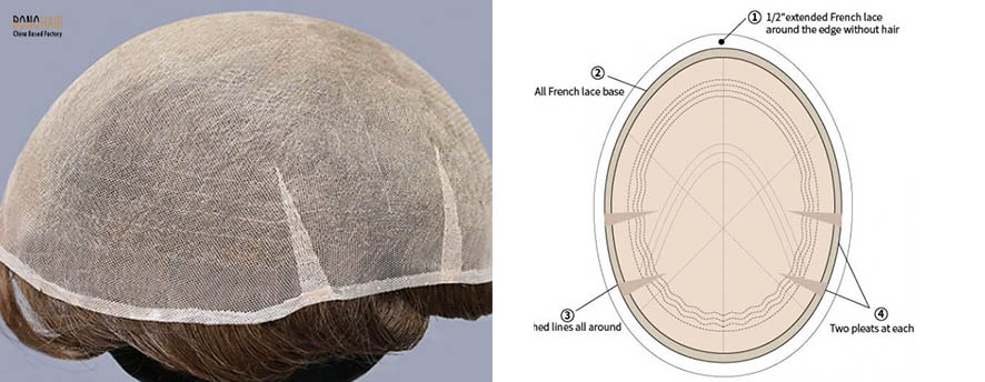 What is Alopecia and Alopecia Treatment (22)