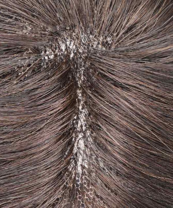 Ex-Australia Skin Lace Hair System Is Poly Around Hair Replacement From Bono Hair