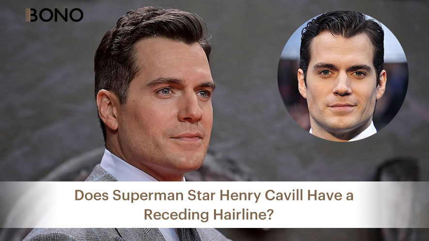 Does Superman star Henry Cavill Have a Receding Hairline (5)