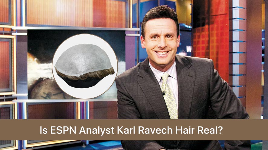 Is ESPN Analyst Karl Ravech Hair Real (2)