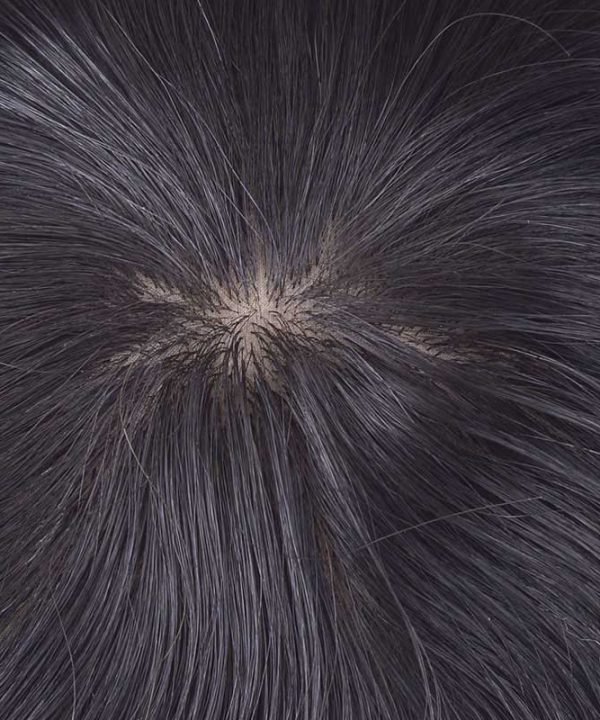 ST Silk Top Hair Patch for Men Men’s Toupee Manufacturer