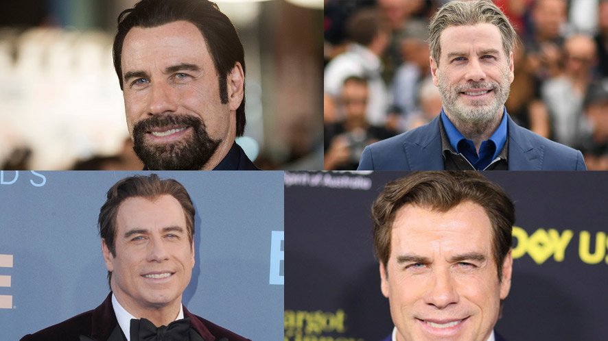 When Did John Travolta Baldness Start?