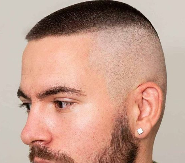 17.High and tight