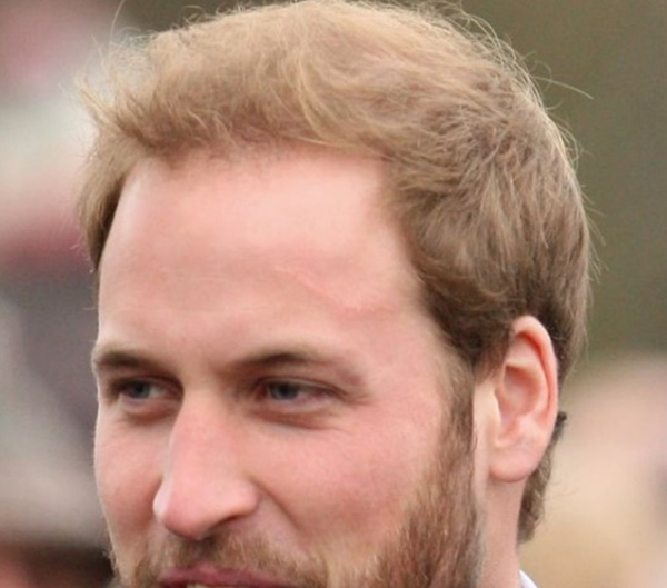 28.Prince William's haircut for men with balding crown