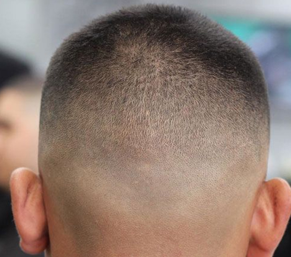 86. Skin Fades with Short Hair for Men with Balding Temple